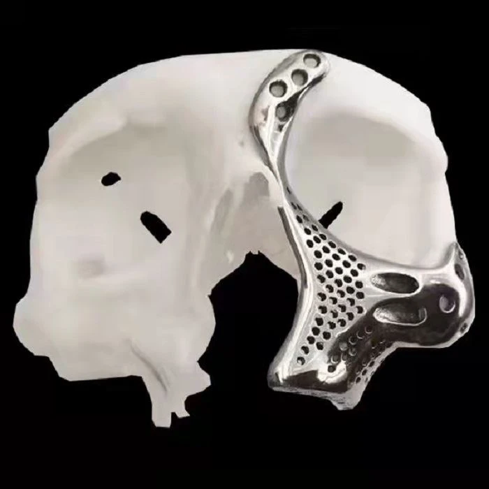 Медицински 3D печат за регенериране на костите